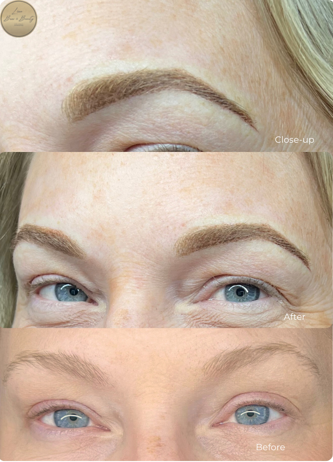 Customized brow shaping before and after